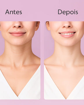 Massageador facial com led Bialma Derma Skin